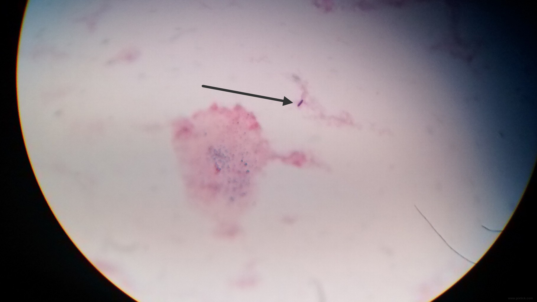 Gram Stain
