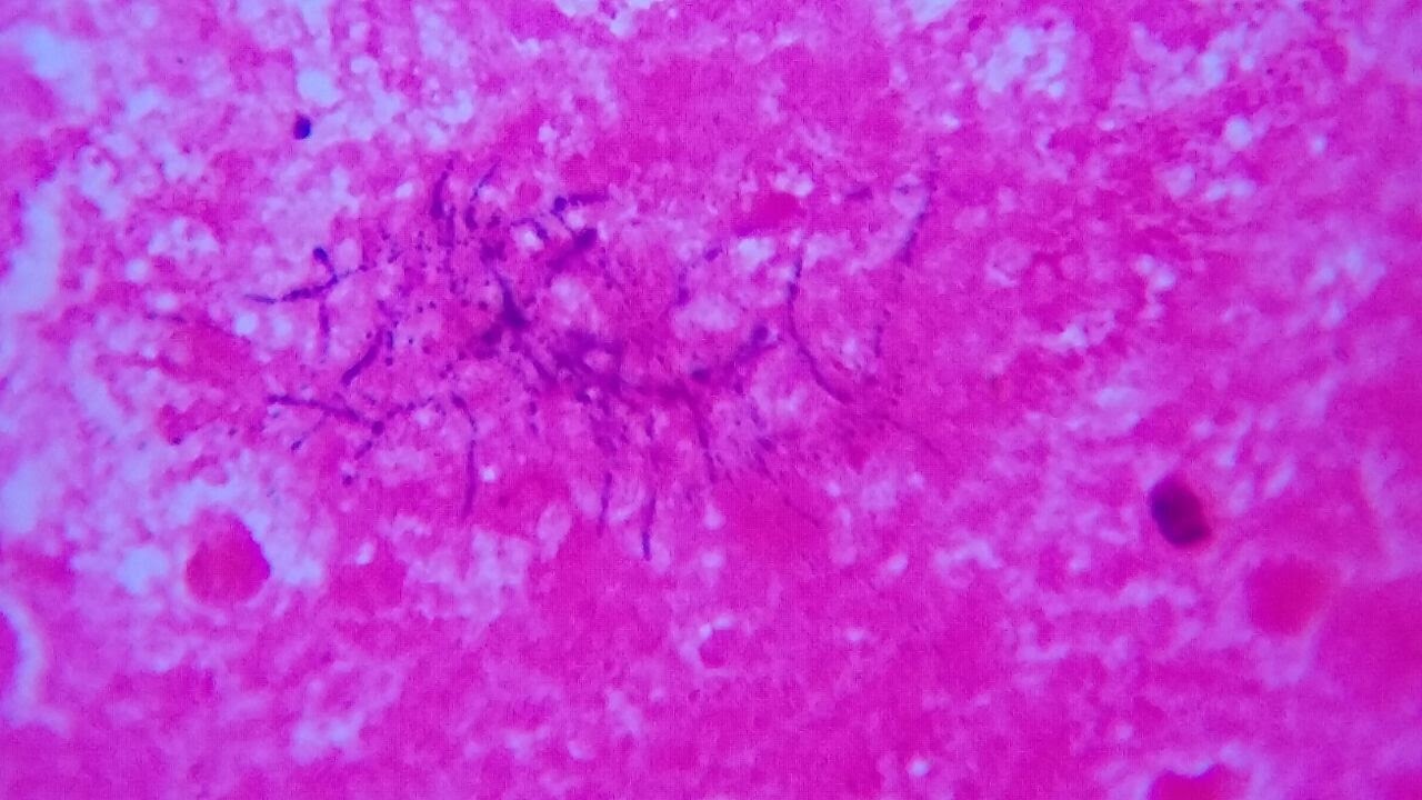 Gram Stain