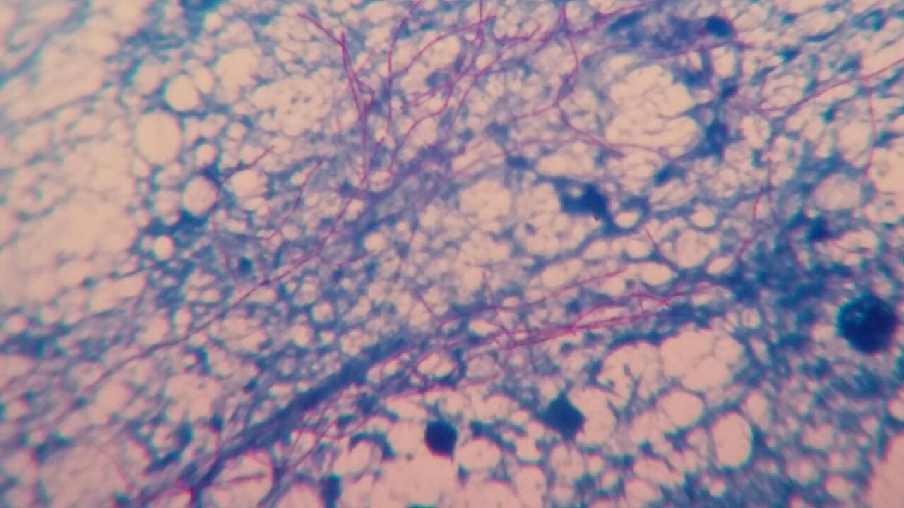 Modified AFB Stain